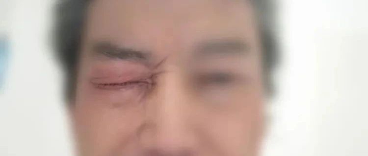 原始點案例:調理視物模糊-七不姜 生姜養生網-明德CSA生態姜園&明安農業