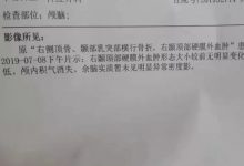 案例分享:車禍導致面癱調理案例-七不姜 生姜養生網-明德CSA生態姜園&明安農業