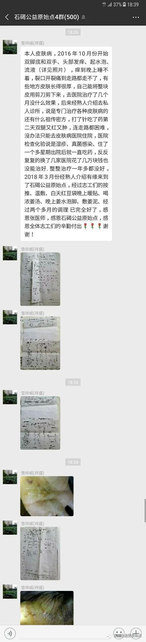 嚴重濕疹，真菌感染