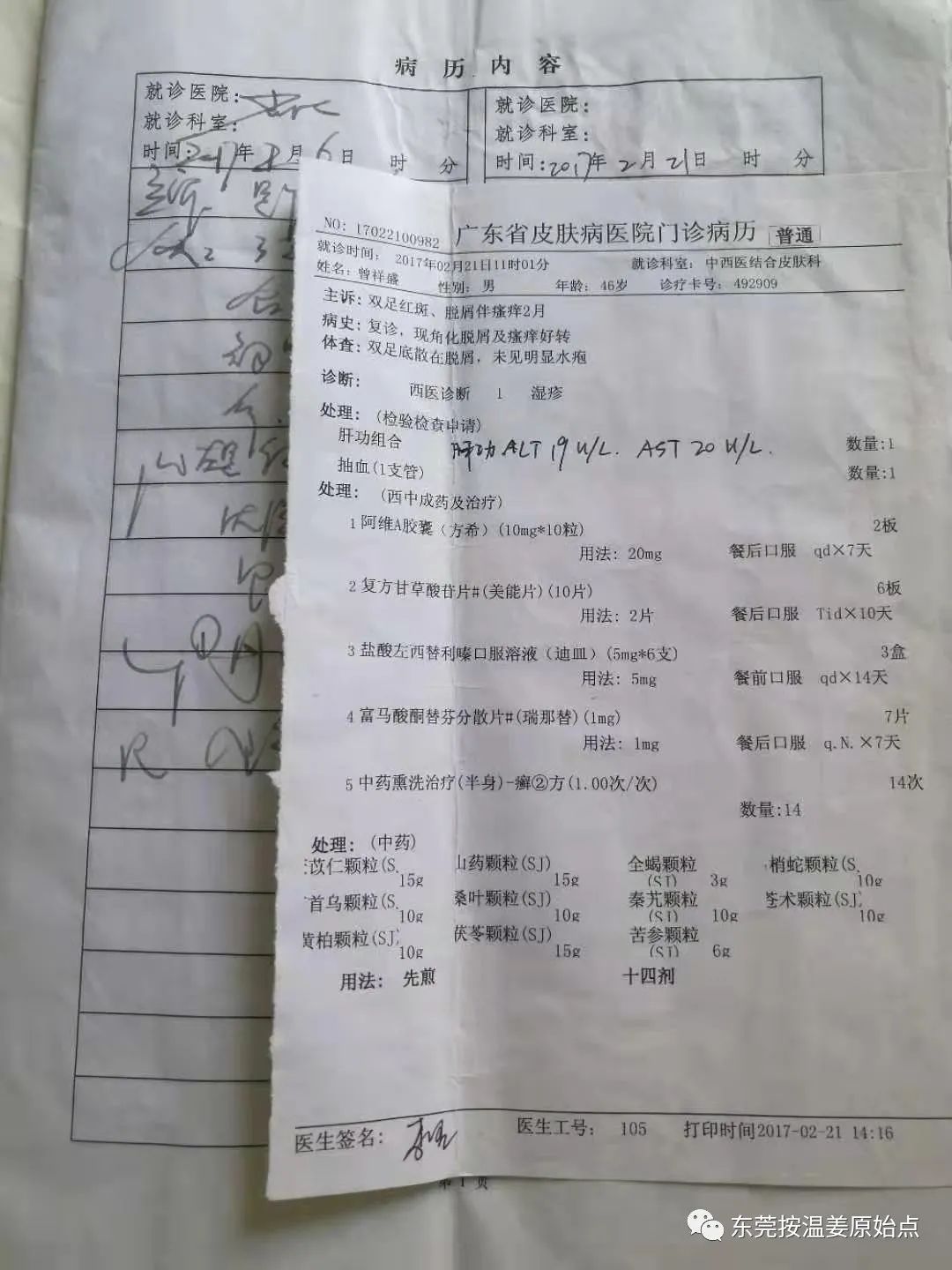 嚴重濕疹，真菌感染