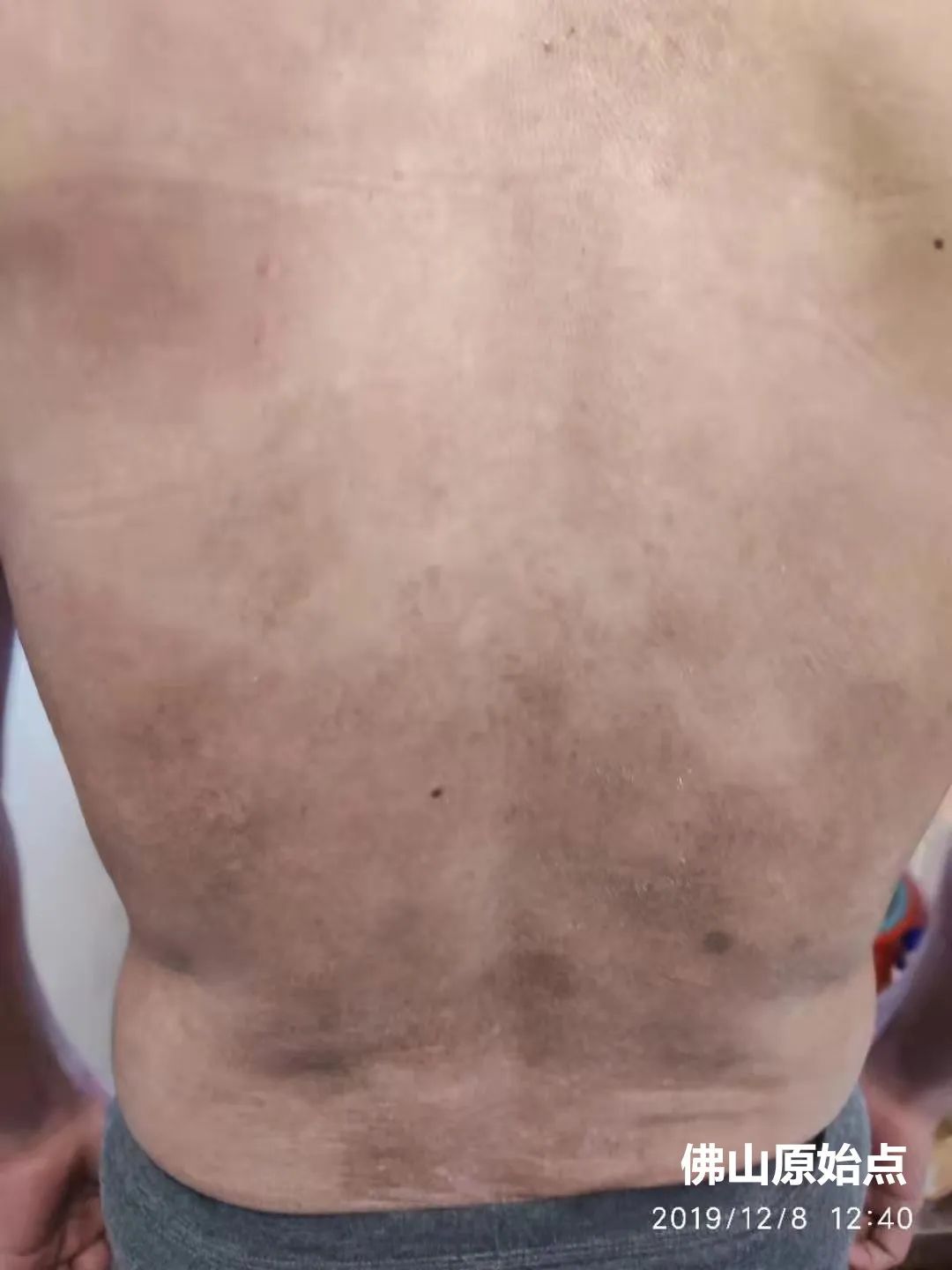 案例分享:原始點調理不孕不育的心路歷程-七不姜 生姜養生網-明德CSA生態姜園&明安農業