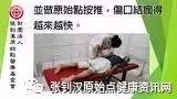 車禍燒傷案例(廣西)-七不姜 生姜養生網-明德CSA生態姜園&明安農業