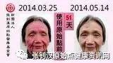 干癬案例(楊女士臉皮膚紅腫)-七不姜 生姜養生網-明德CSA生態姜園&明安農業