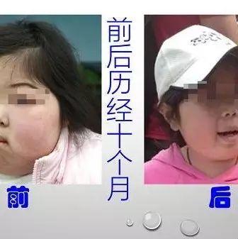 腎病癥候群案例(簡體版)-七不姜 生姜養生網-明德CSA生態姜園&明安農業