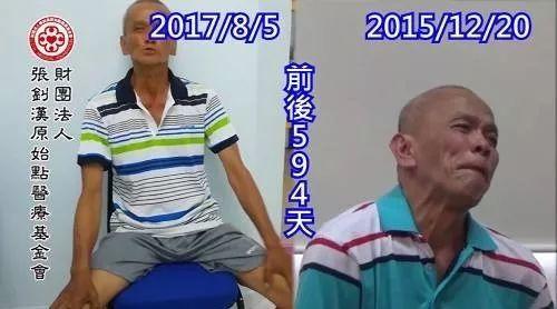 梅杰綜合癥案例--2017.10最新案例-七不姜 生姜養生網-明德CSA生態姜園&明安農業