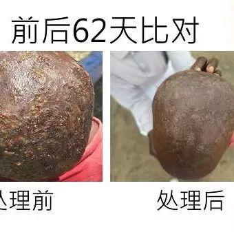 頭部感染案例(辛巴威小女孩探訪)(簡體版)-七不姜 生姜養生網-明德CSA生態姜園&明安農業