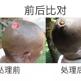 頭部潰爛案例(簡體版)-七不姜 生姜養生網-明德CSA生態姜園&明安農業