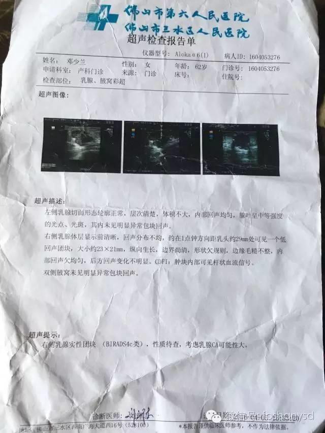 原始點調理乳腺癌四十多天恢復健康，63歲阿姨每天可做300個起俯運動