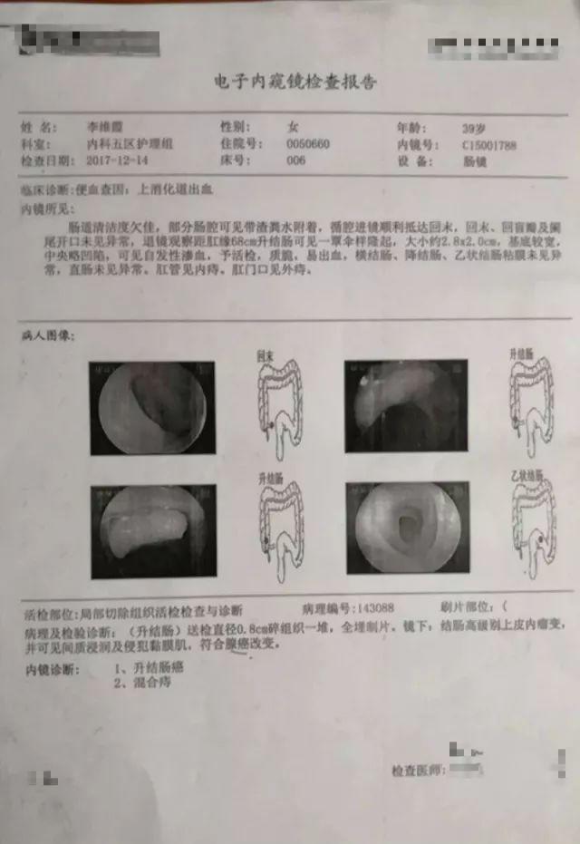 原始點調理結腸癌:境隨心轉 原始點調理結腸癌:境隨心轉