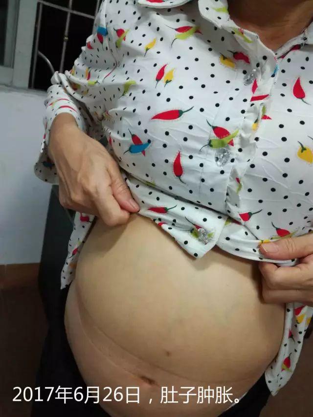 原始點調理腹水雙下肢水腫:清晰的觀念+信心 成就健康 原始點調理腹水雙下肢水腫:清晰的觀念+信心 成就健康