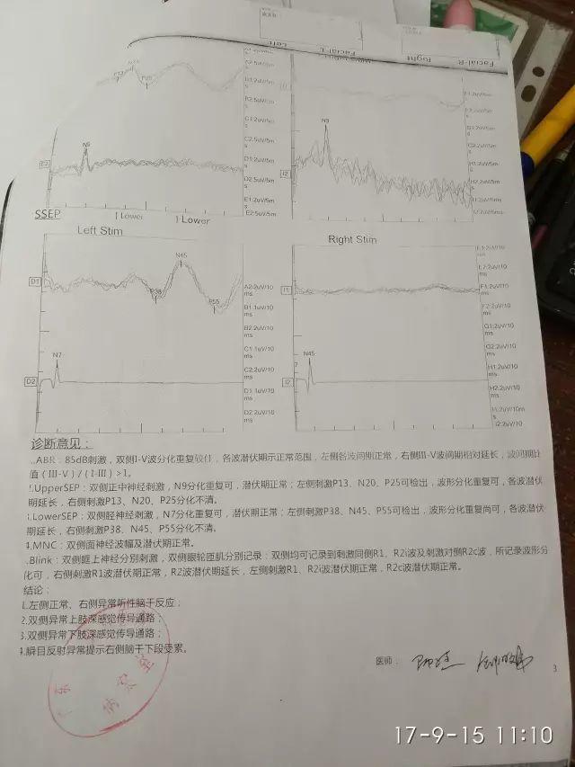 原始點調理腦膠質瘤:告別風雨見陽光 原始點調理腦膠質瘤:告別風雨見陽光
