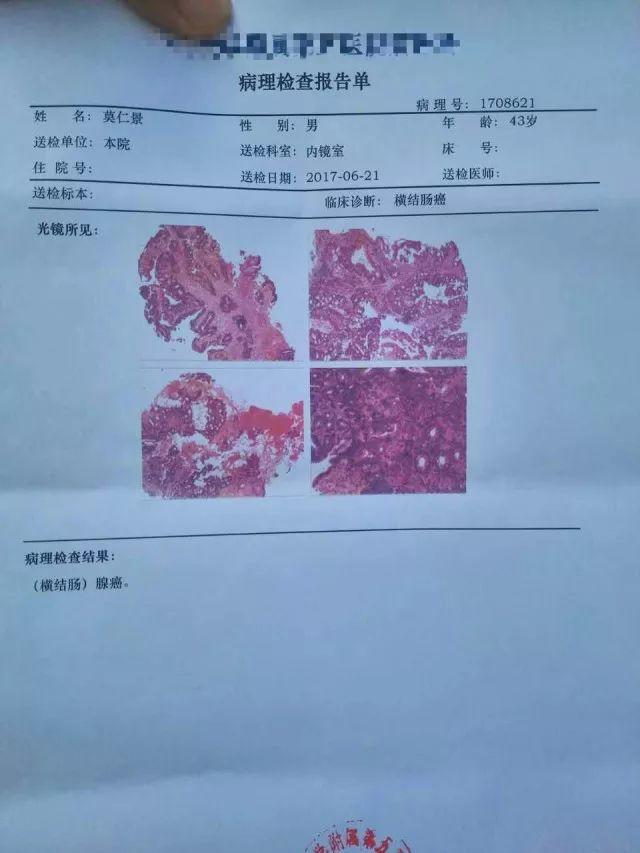 原始點調理結腸癌:不及是缺少,過量是消耗 原始點調理結腸癌:不及是缺少,過量是消耗