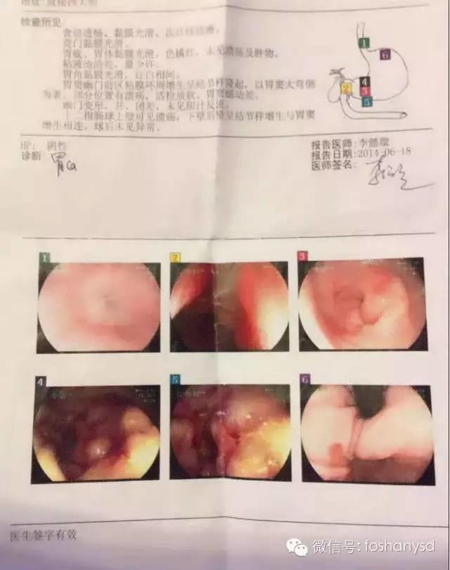 北京原始點中心案例 | 叢女士自述胃癌案例