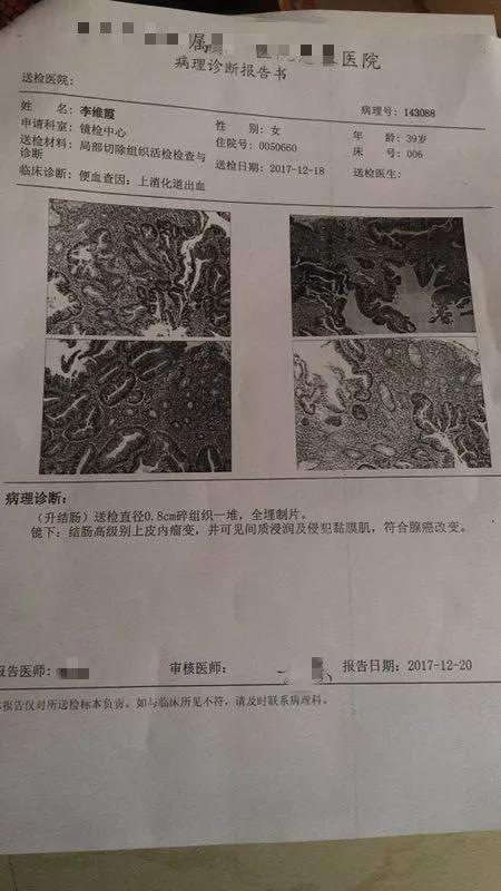 原始點調理結腸癌：境隨心轉