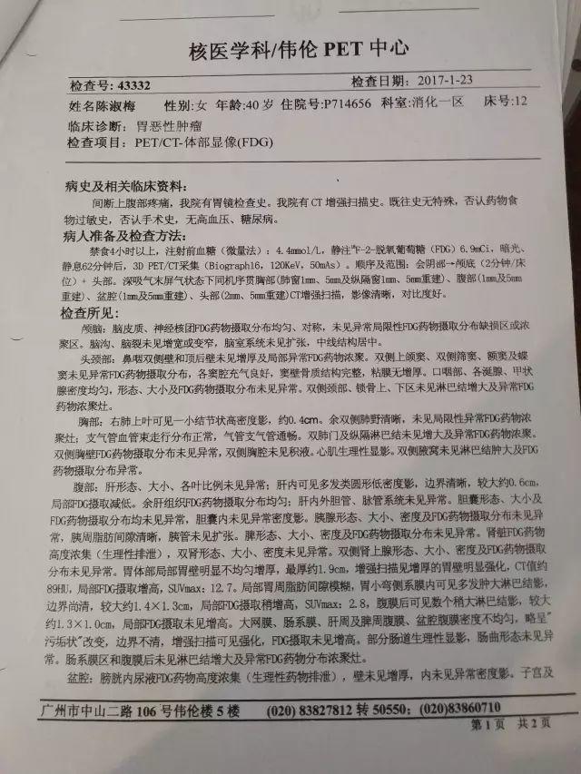 原始點調理胃癌：云淡風輕
