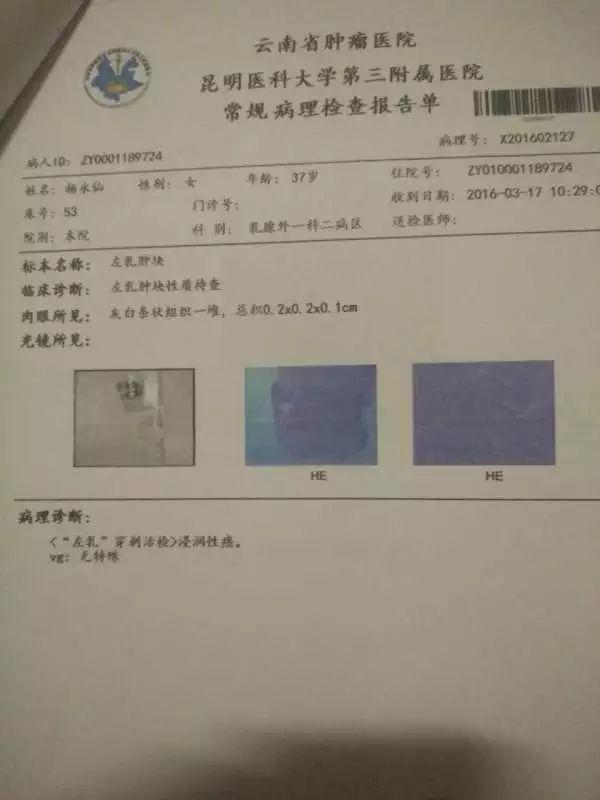 原始點調理乳腺癌：《柳暗花明又一村》