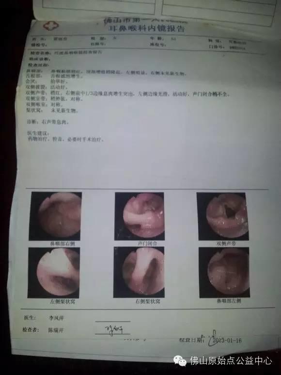 中晚期結腸癌八個月原始點理療基本康復