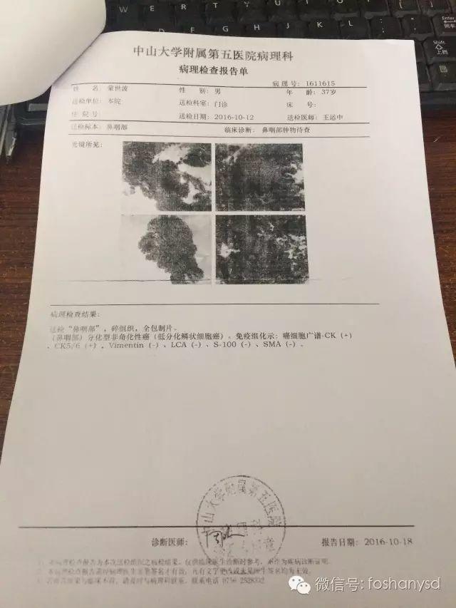 原始點調理三期鼻咽癌:精進實干者的”神器“ 原始點調理三期鼻咽癌:精進實干者的”神器“