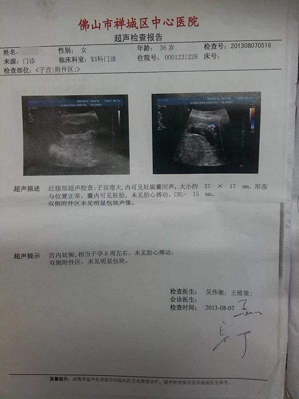 原始點成功助排子宮終止妊娠胎兒