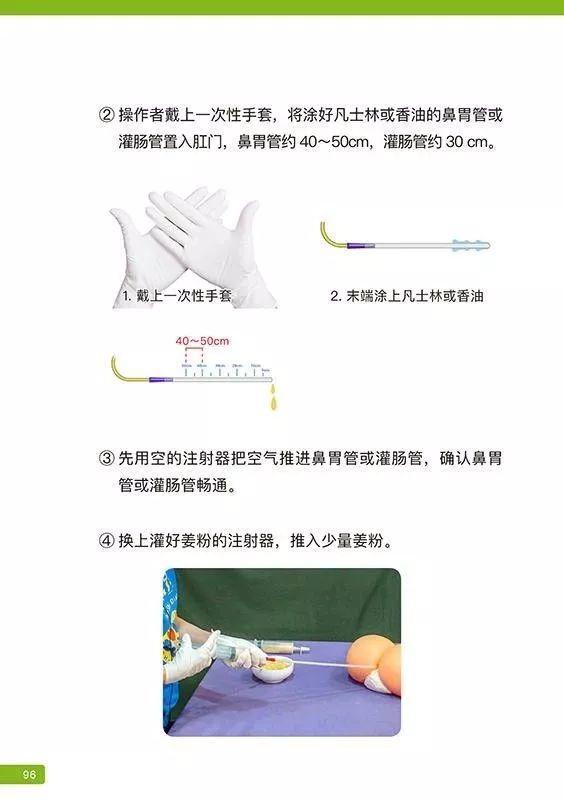 姜粉灌腸步驟-更新版（2020年2月）