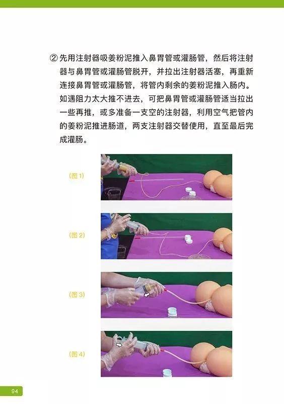 姜粉泥灌腸步驟-更新版（2020年1月）