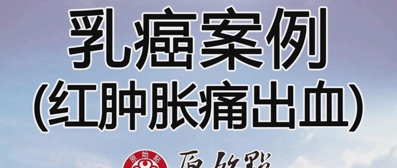 乳癌案例(2)-紅腫脹痛儲出血(紐約)-七不姜 生姜養生網-明德CSA生態姜園&明安農業