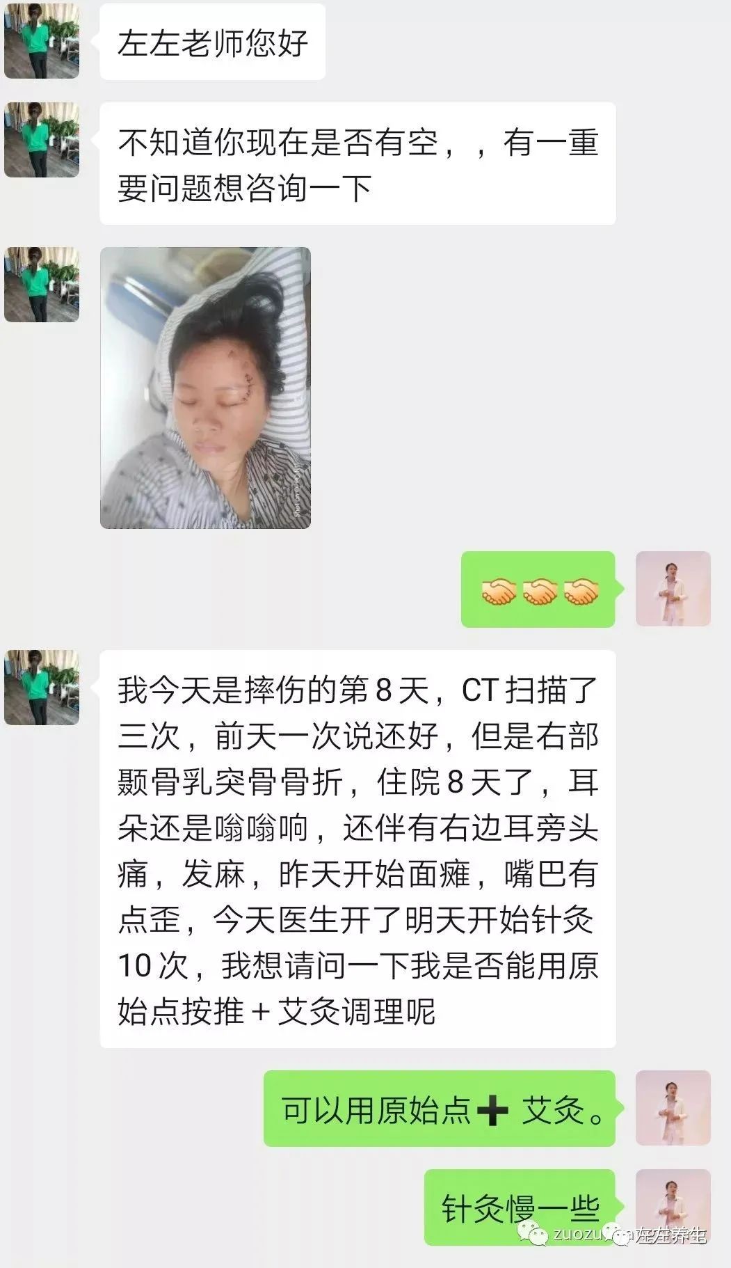 案例分享:車禍導致面癱調理案例 案例分享:車禍導致面癱調理案例