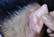 案例分享:不孕,小兒夜啼、奶水不足調理案例-七不姜 生姜養生網-明德CSA生態姜園&明安農業