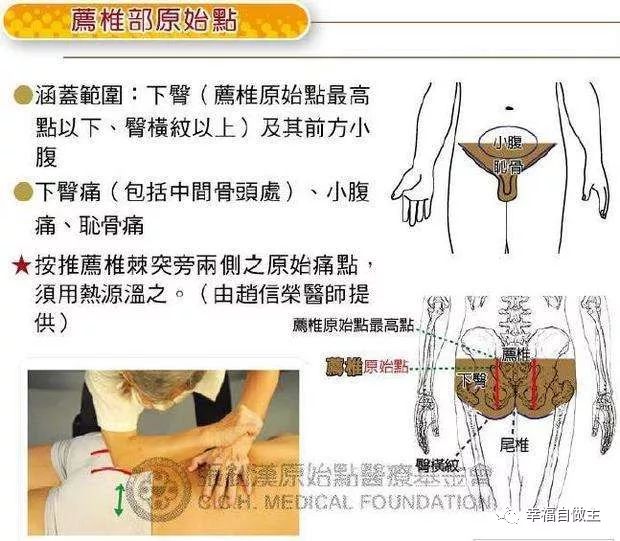 多年頑固性便秘案例！