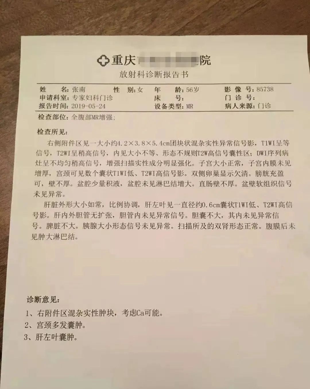 【原始點案例】用原始點調理附件腫瘤案例! 【原始點案例】用原始點調理附件腫瘤案例!