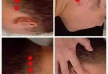 微問答14期:全身癢十幾年了怎么調理?-七不姜 生姜養生網-明德CSA生態姜園&明安農業