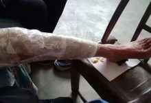 案例分享:85歲老人腿痛、無力,“種”發的案例-七不姜 生姜養生網-明德CSA生態姜園&明安農業