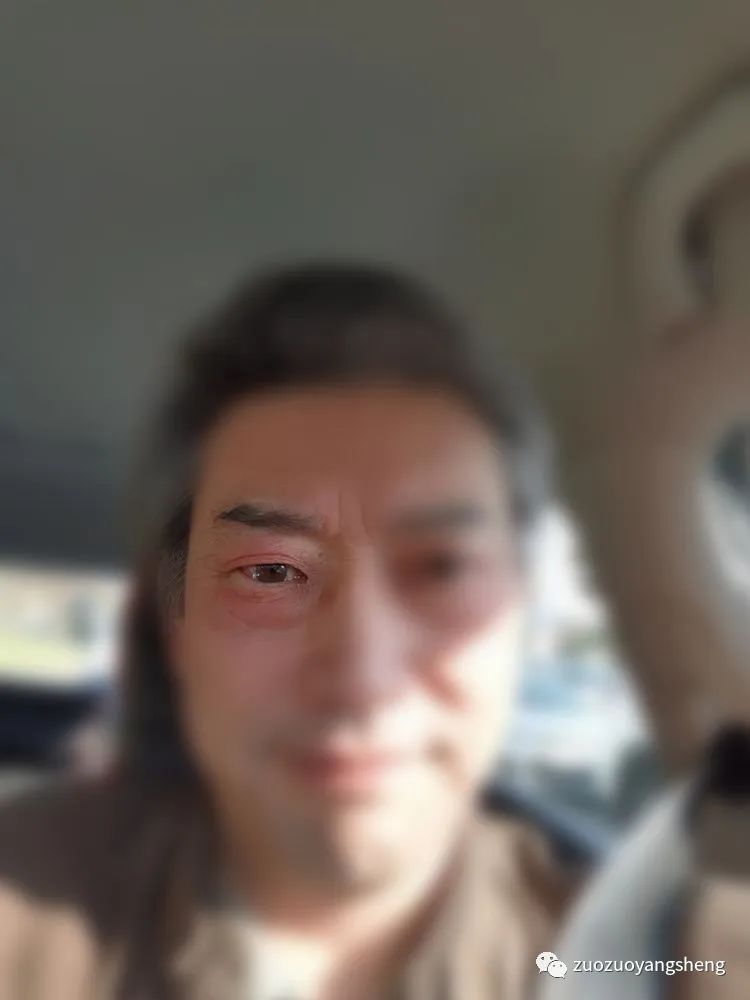 原始點案例：調理視物模糊