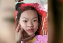 案例分享:兒童十年便秘調理案例-七不姜 生姜養生網-明德CSA生態姜園&明安農業