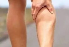 案例分享:腿痛麻木、無力調理案例-七不姜 生姜養生網-明德CSA生態姜園&明安農業