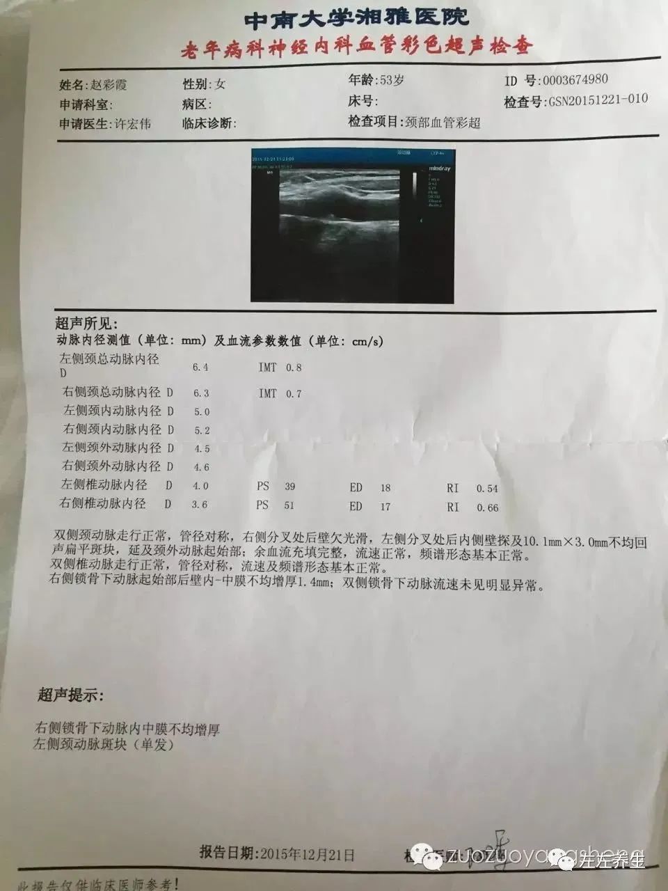 案例分享：半身不遂患者調理25次基本康復調理案例