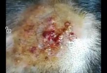 案例分享:小孩毛囊炎反復發作調理案例-七不姜 生姜養生網-明德CSA生態姜園&明安農業