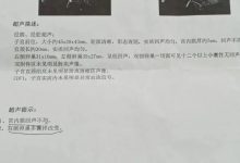 案例分享:多囊卵巢綜合征與月經長達三個月的案例-七不姜 生姜養生網-明德CSA生態姜園&明安農業