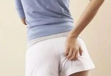 案例分享:痔瘡突發大出血調理案例-七不姜 生姜養生網-明德CSA生態姜園&明安農業