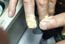 案例分享:手指夾傷后血流不止調理案例-七不姜 生姜養生網-明德CSA生態姜園&明安農業