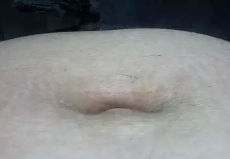 看一眼肚臍就知道你啥毛病！別不信！