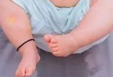 案例分享:小孩尿床的調理案例-七不姜 生姜養生網-明德CSA生態姜園&明安農業