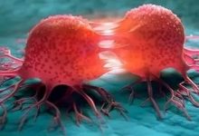 微問答10期:姑姑得了乳腺癌,老公卻見死不救?-七不姜 生姜養生網-明德CSA生態姜園&明安農業