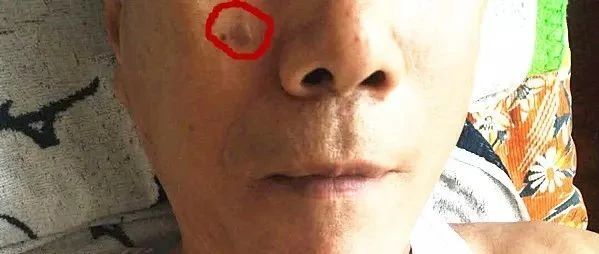 姜湯洗掉了老年斑-七不姜 生姜養生網-明德CSA生態姜園&明安農業