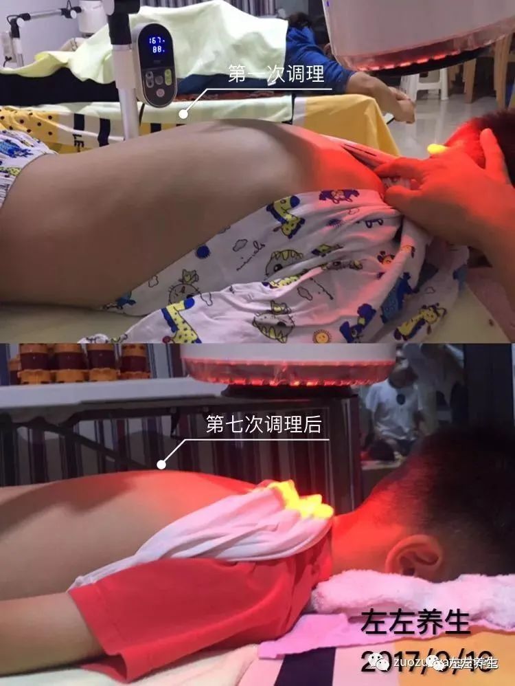 未雨綢繆，如何把握孩子長高季長高？