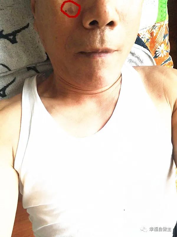 姜湯洗掉了老年斑