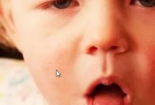 案例分享:小兒肺炎調理案例-七不姜 生姜養生網-明德CSA生態姜園&明安農業