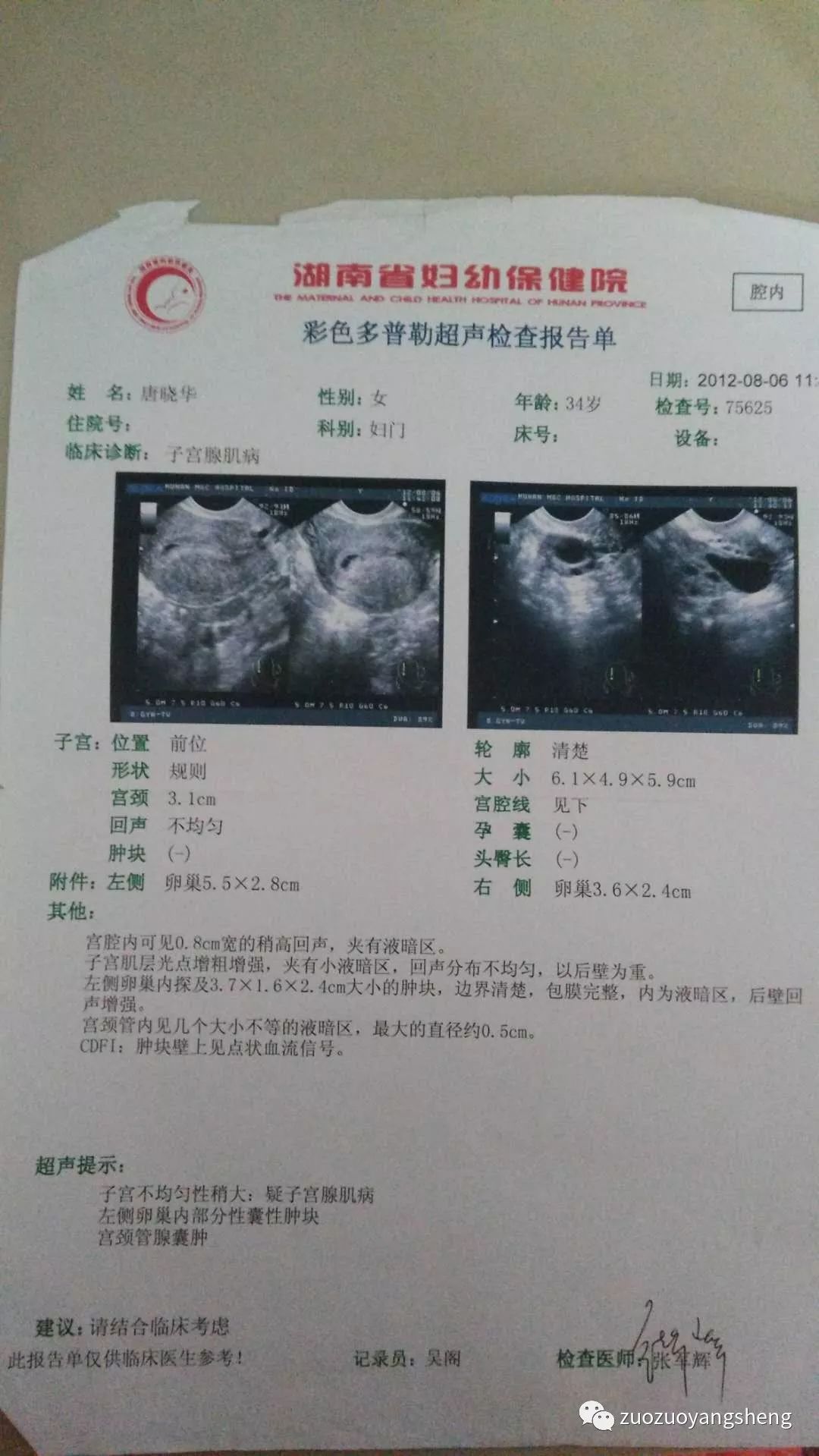 堅持原始點調理,43天排出死胎的案例 堅持原始點調理,43天排出死胎的案例