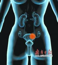 子宮肌瘤、乳腺癌原來是這么回事！看完我目瞪口呆！