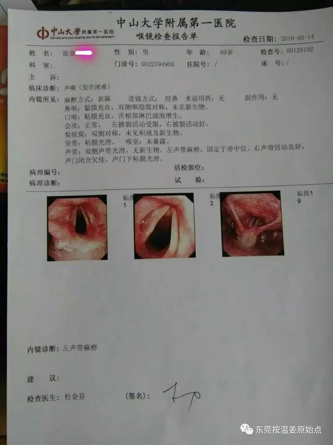 聲帶麻痹，說話費力、沙啞，咽痛